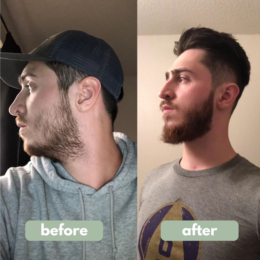 Daily Beard Renew Serum