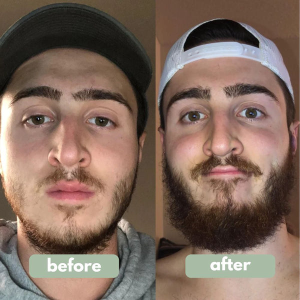 Reverse Daily Beard Boost Serum